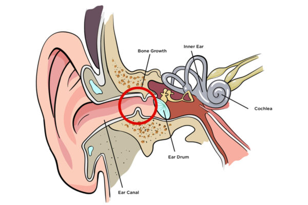earforweb-1 earforweb-1