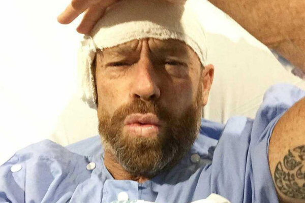 tom-carroll-in-pain-e1526638518999 tom-carroll-in-pain-e1526638518999